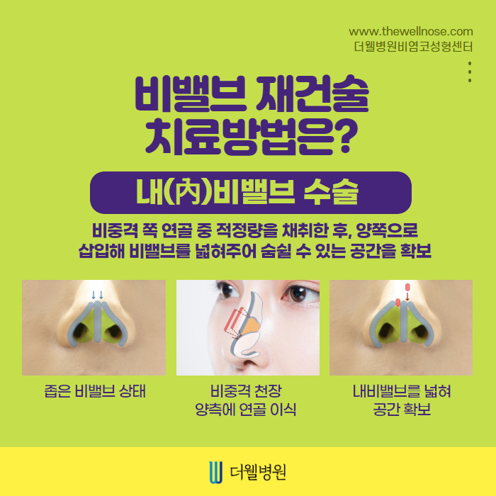 더웰병원 ce1284fc088b2abcacb9dca766c46b9e_1698891945_6165