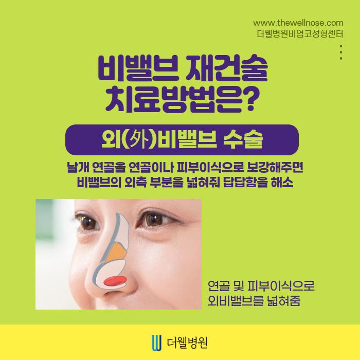 더웰병원 ce1284fc088b2abcacb9dca766c46b9e_1698891945_7521
