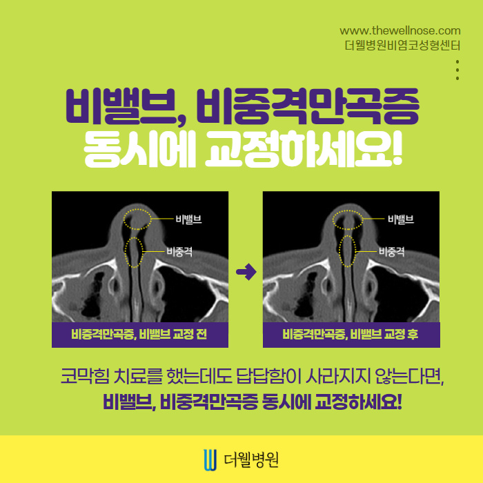 더웰병원 ce1284fc088b2abcacb9dca766c46b9e_1698891945_8853