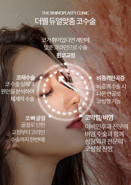 더웰병원 코재수술, 코수술, 코성형 더웰병원