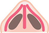 더웰병원 비밸브 재건술