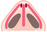 더웰병원 비밸브 재건술