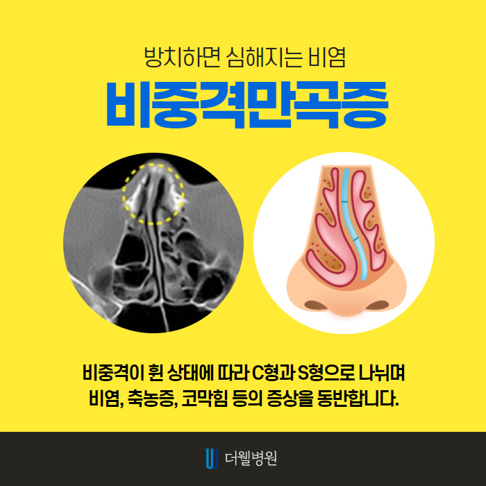 ce1284fc088b2abcacb9dca766c46b9e_1698891968_5631.jpg 더웰병원 ce1284fc088b2abcacb9dca766c46b9e_1698891968_5631