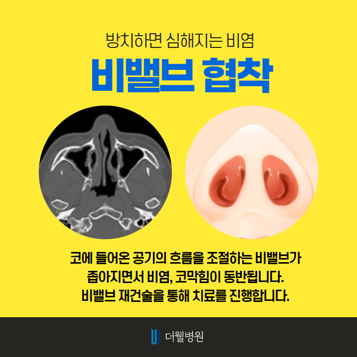 ce1284fc088b2abcacb9dca766c46b9e_1698891968_6812.jpg 더웰병원 ce1284fc088b2abcacb9dca766c46b9e_1698891968_6812