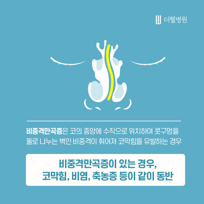 더웰병원 ce1284fc088b2abcacb9dca766c46b9e_1698891993_0375
