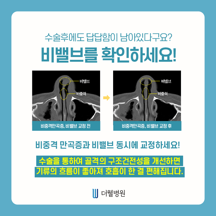 더웰병원 ce1284fc088b2abcacb9dca766c46b9e_1698891993_9549